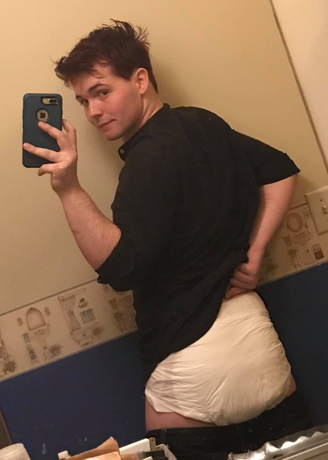 Kehidupannya yang tidak biasa tersebut berpengaruh ke berbagai aspek hidupnya. Damien dipecat dari pekerjaannya hingga teman-temannya meninggalkannya.  Foto: Facebook