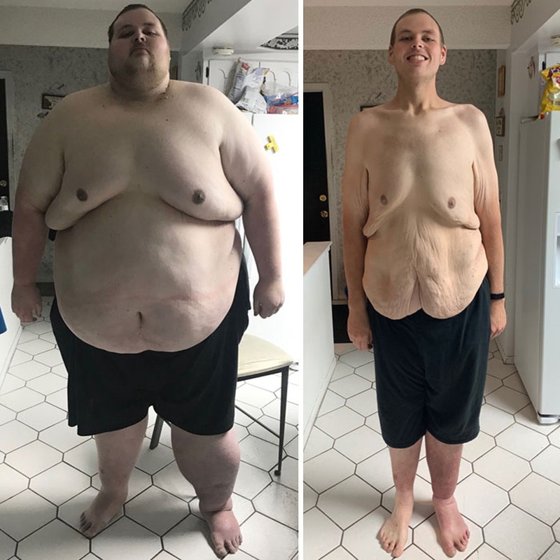 fotoinet diet viral