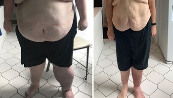 Merayakan 2 tahun dalam perjalanan proses penurunan berat badan kemarin! turunkan berat badan melalui diet, banyak berenang, jalan-jalan dan bersepeda tanpa operasi semuanya mungkin! Foto: Boredpanda
