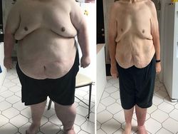 Potret Viral Diet Sukses, Biar Jadi Inspirasi