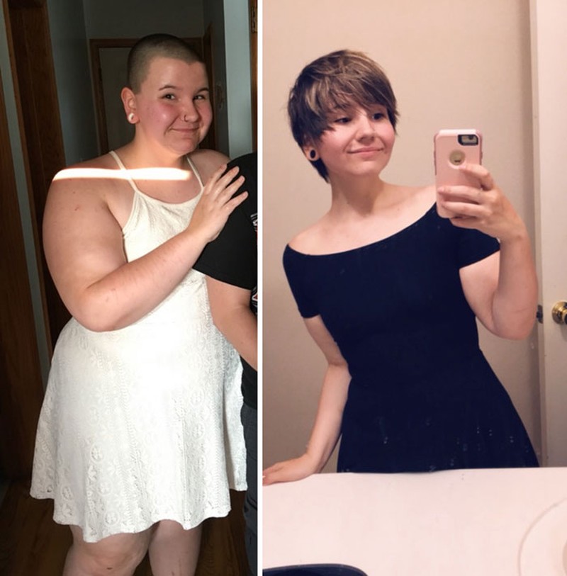 fotoinet diet viral
