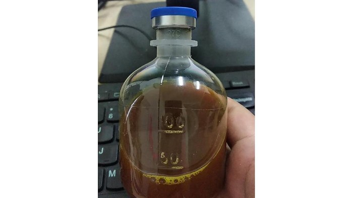 This August 2020, photo provided by a Uighur under quarantine shows a bottle of unidentified traditional Chinese medicine in Urumqi, China. As parts of the Xinjiang region in Chinas far northwest enters the 45th day of a second grueling lockdown due to a coronavirus outbreak, the government there is coercing some residents into using traditional Chinese medicine despite a lack of rigorous clinical data proving it works. (AP Photo)