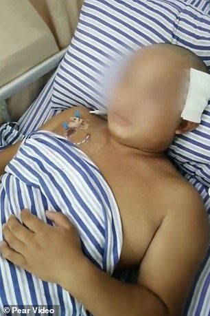 Selama 17 Tahun Cacing Hidup di Dalam Otak Pria Ini