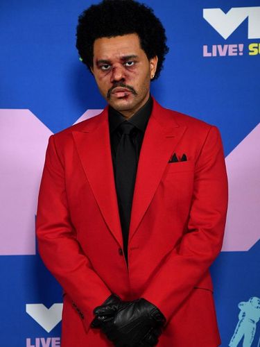 The Weeknd tampil dengan wajah lebam di MTV VMA 2020.