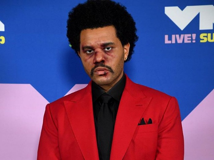 The Weeknd tampil dengan wajah lebam di MTV VMA 2020.