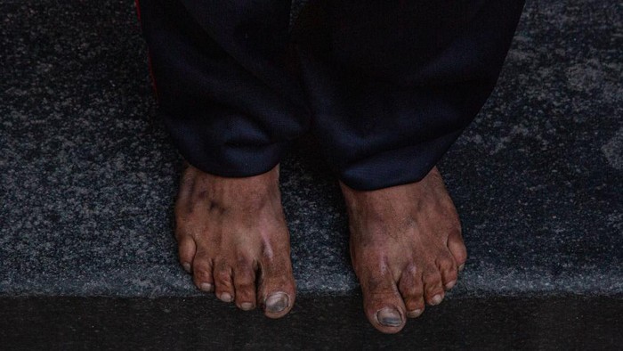SAO PAULO, BRAZIL - AUGUST 28: A homeless person sleeps in the sidewalk next to a closed shop at the city centre on August 28, 2020 in Sao Paulo, Brazil. According to an official survey by the Municipality of Sao Paulo, homelessness increased 53% in the capital city over the last five years, reaching a total of more than 25,000 homeless people. Due to the pandemic, unemployment is rising and the number of people living on the streets has increased considerably. The situation worsens during winter with intense cold at night as two deaths have already been recorded. Many of these homeless people prefer staying on the streets rather than going to shelters for fear of contracting coronavirus (COVID-19), and survive only with the help of NGOs and social projects that donate blankets, clothing and food. (Photo by Alexandre Schneider/Getty Images)