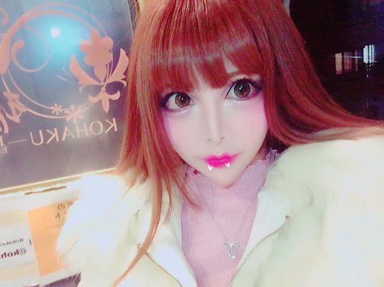 Penampilan Wanita Jepang 100 Kali Operasi Plastik Demi Jadi Boneka Prancis