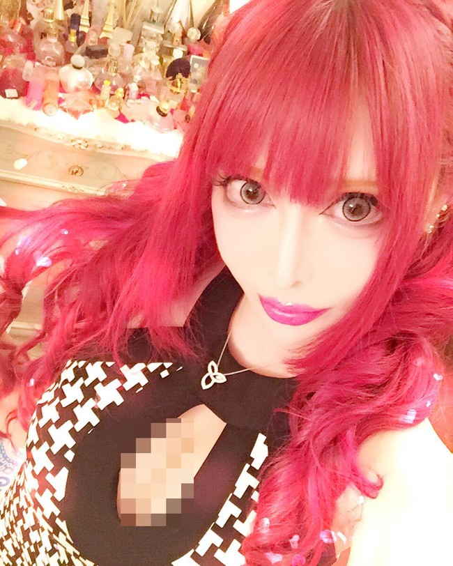 Vanilla juga sempat berbicara mengenai orangtuanya yang dikatakan tidak melarangnya operasi bahkan mengatakan jika anaknya memang jelek.  Ia pun merasa tidak disayangi seperti saudara-saudaranya yang lain saat kecil. Ketika aku memikirkannya sekarang, aku tumbuh dengan perasaan bahwa aku tidak diinginkan,  katanya. Foto: Instagram @vani0531