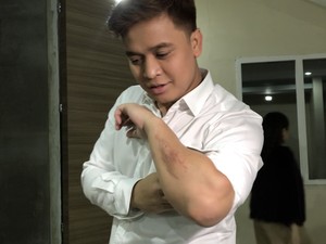 Billy Syahputra Jatuh dari Motor Trail, Amanda Manopo: Dia Emang Sombong