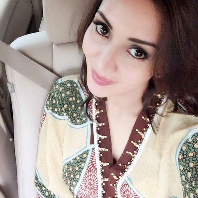 Jaksa Pinangki sendiri dikabarkan melakukan operasi hidung dengan dibantu dr. Andrew Jacono, yang merupakan dokter paling top di New York Center for Plastic Surgery. dr. Andrew dikenal sebagai kreator dari M.A.D.E. (Minimal Access Deep Plane Extended), sebuah prosedur facelift dengan minimal invasiv. Foto: Instagram @pinangkit, Dok. Facebook