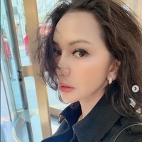 Operasi hidung disebut-sebut dilakukan dr. Andrew Jacono pada Jaksa Pinangki. Prosedur operasi hidung yang dilakukan Pinangki populer dengan nama rhinoplasty. Dalam situs New York Center for Plastic Surgery disebutkan rhinoplasty atau operasi hidung termasuk salah satu operasi plastik populer di Amerika Serikat. Rhinoplasty merupakan prosedur untuk membentuk hidung sehingga penampilannya lebih baik. Sebagian besar operasi hidung dilakukan dengan tujuan untuk kosmetik alias penampilan, namun ada juga yang karena masalah kesehatan. Foto: Instagram @pinangkit, Dok. Facebook