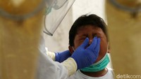 Ekspresi seorang anak saat alat swab masuk ke hidungnya.