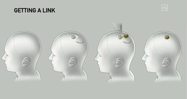Neuralink