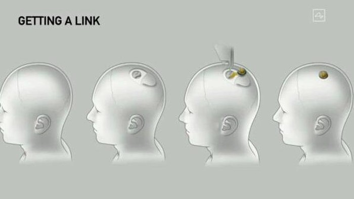 Neuralink
