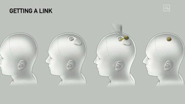 Neuralink