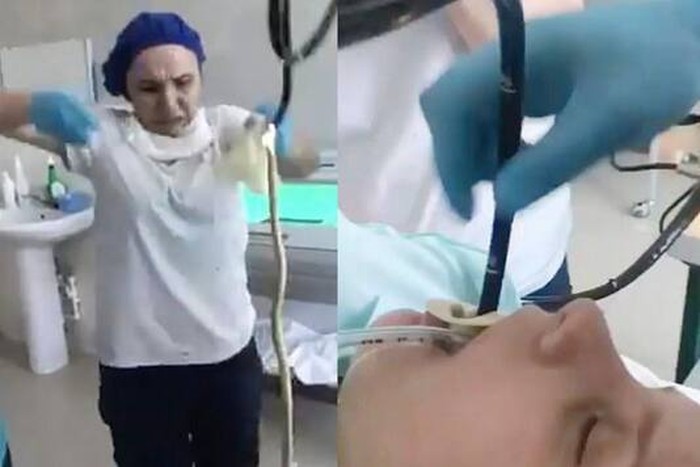 Ngeri! Wanita Ini Tak Sengaja Menelan Ular Saat Sedang Tidur