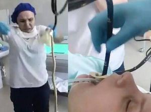 Ngeri! Wanita Ini Tak Sengaja Menelan Ular Saat Sedang Tidur
