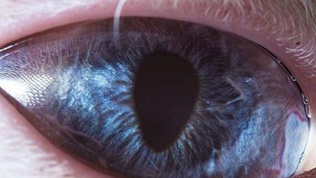 Bisa menebaknya? Betul, ini mata kucing, Foto: Suren Manvelyan via Boredpanda