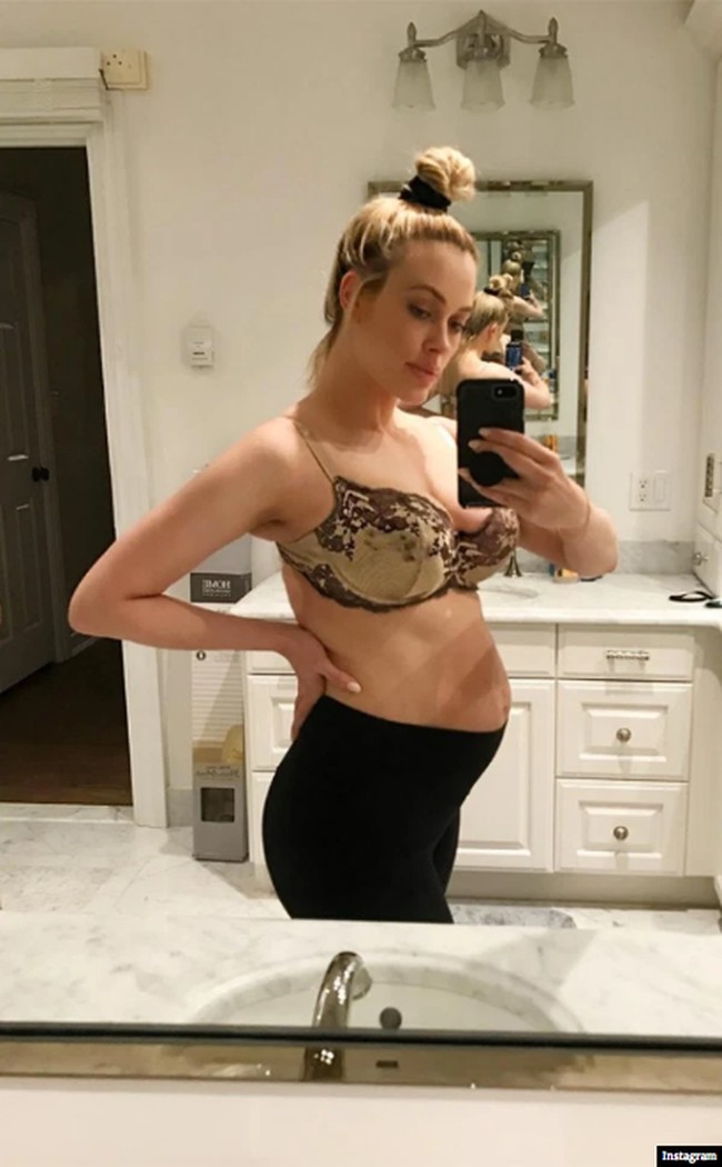 Bintang Dancing With the Stars Peta Murgatroyd berpose selfie memperlihatkan perutnya yang terlihat seperti masih hamil di saat dia sudah melahirkan bayinya. Ini kenyataan. Aku mengambil foto ini delapan hari setelah melahirkan. Aku meninggalkan rumah sakit dengan terlihat seperti hamil lima bulan. Banyak orang berpikir wanita seharusnya langsung mengecil setelah bayi lahir. Tentu saja itu anggapan yang tidak benar, tulisnya di Instagram. Foto: Instagram