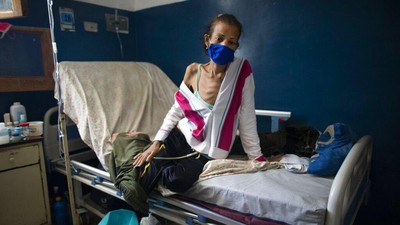 Potret Pasien Kanker di Venezuela Bertahan Hidup di Tengah Pandemi