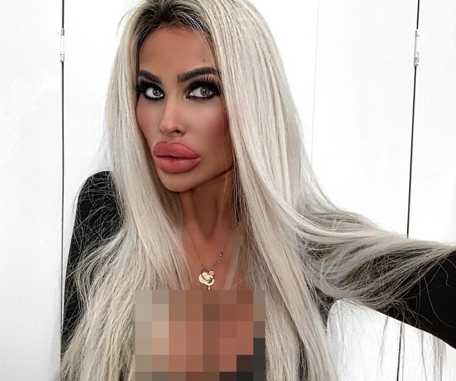 Lihat saja bibir Tara yang begitu tebal. Bibirku adalah ciri khasku, ucapnya seperti dikutip The Sun.  Foto: Instagram