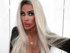 Foto: Wanita yang Disebut Mirip Boneka Seks Setelah Implan Payudara 5 Kali
