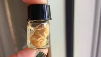 Orang ini menyimpan fetus atau janin seekor tikus, hmmm agak menyeramkan ya. Foto: Gerret Hayslip via Bored Panda