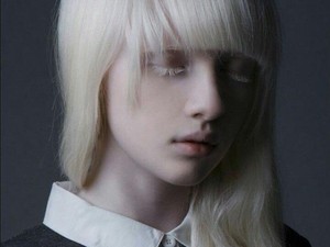 Berkulit Albino, 6 Wanita Ini Buktikan Mereka Bisa Sukses Jadi Model
