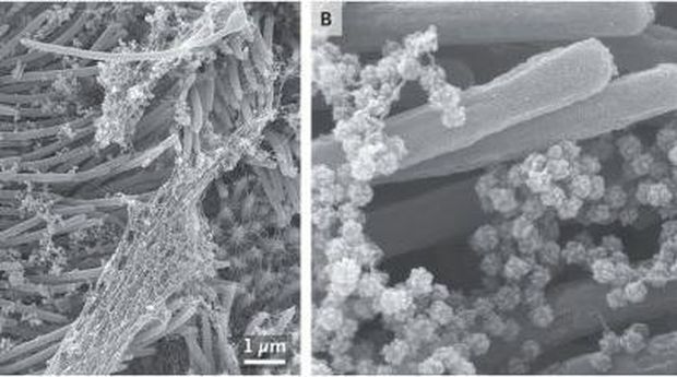 sel terinfeksi virus corona sel terinfeksi virus corona
