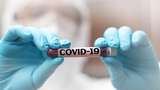 Riset RI Temukan COVID-19 pada Sperma Pasien Corona Tanpa Gejala