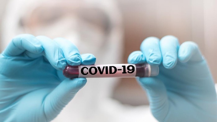 Ilustrasi COVID-19 COVID-19 named by WHO for Novel coronavirus NCP concept. Doctor or lab technician in PPE suit holding blood sample with novel (new) coronavirus in Wuhan, Hubei Province, China, medical and healthcare