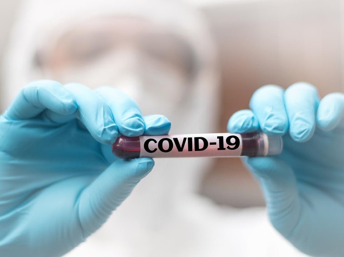 COVID-19 named by WHO for Novel coronavirus NCP concept. Doctor or lab technician in PPE suit holding blood sample with novel (new) coronavirus  in Wuhan, Hubei Province, China, medical and healthcare