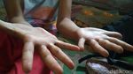 Hobi Panjat Lemari-Pohon, Ini Adelia Spiderman Cilik dari Pekalongan