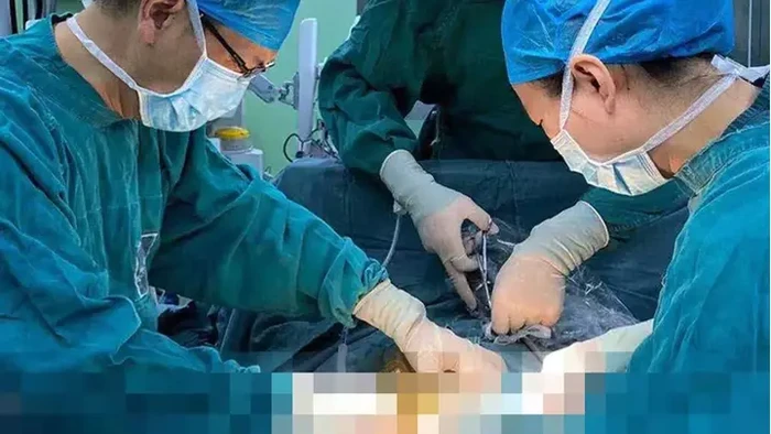 Iseng Masukkan Gelas Bir ke Bokong, Pria Ini Harus Dioperasi
