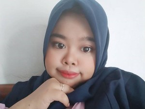 Viral Kekeyi Operasi Hidung, Netizen Takjub Lihat Before-After-nya