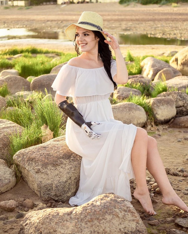 Wanita yang menggunakan tangan bionik itu kini menjadi aktivis yang menyuarakan tentang kekerasan dalam hubungan.  Foto: dok. Instagram