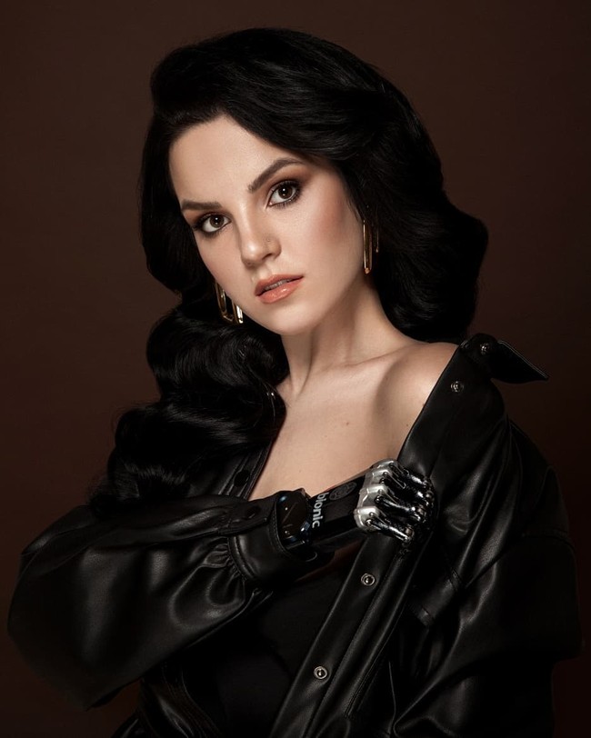 Kejadian tersebut membuat Margarita kehilangan tangannya. Kini wanita 27 tahun itu menggunakan tangan palsu.  Foto: dok. Instagram