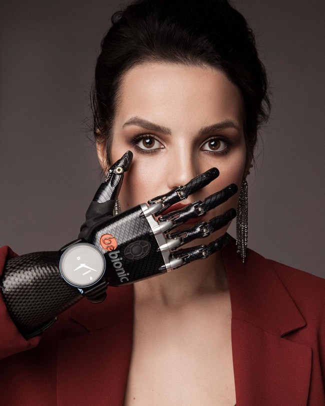 Margarita Grachyova, wanita asal Rusia yang jadi viral di 2017 karena jadi korban kekerasan dalam rumah tangga. Saat itu dia masih menikah dengan pria bernama Dmitry Grachyov. Dmitry melakukan aksi sadis dengan memotong tangan Margarita.  Foto: dok. Instagram