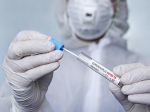 Rekomendasi Pakar ke Menkes Perbaiki Testing Corona di RI yang Salah