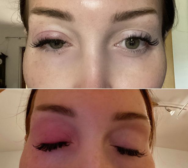 Conny Hawk Mata bengkak Conny Hawk setelah melakukan extension bulu mata