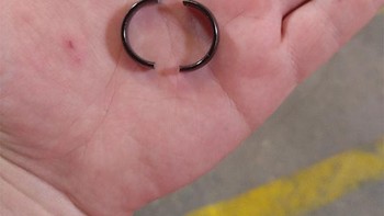 Cincin yang sempit dan sulit dilepaskan dari jari. Beruntung ia tidak terjebak karena cicinnya patah dengan sendirinya. Foto: Boredpanda