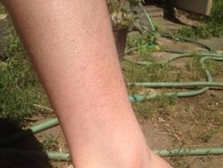 Potret Viral Lolos dari Sial dan Maut yang Sangat Dekat