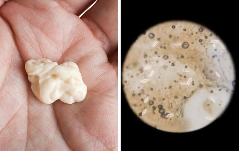 fotoinet mikro benda sekitar