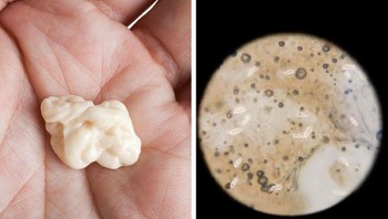 Kunyahan permen karet. Foto: Brightside