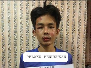 Jaksa Terima SPDP Penusuk Syekh Ali Jaber, Ada Jeratan Pasal Pembunuhan