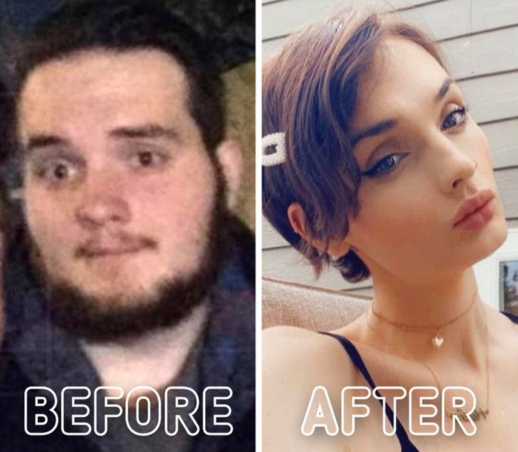 fotoinet transformasi before after gender