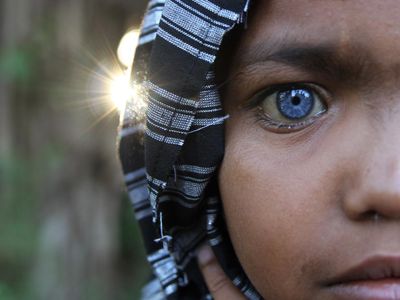 Ini Dia Bocah yang Viral Karena Punya Mata Biru