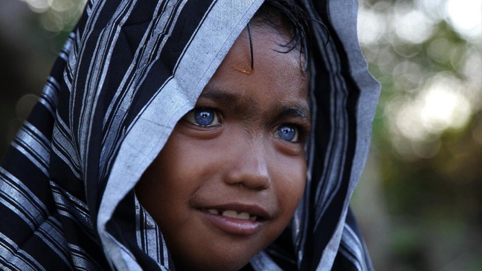 Seorang anak dari Suku Buton, Fardan memiliki mata berwarna biru di Kendari, Sulawesi Tenggara, Selasa (15/9/2020). Fardan merupakan salah satu dari belasan orang Suku Buton di Sulawesi Tenggara yang memiliki  Sindrom Waardenburg yaitu kelainan genetik langka yang menyebabkan mata berwarna biru. ANTARA FOTO/Jojon/pras.