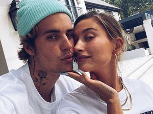 Begini Cara Hailey Baldwin Bantu Justin Bieber Atasi Jerawat Dewasa