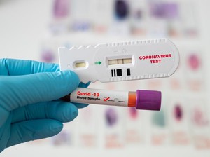 Berujung Pelecehan Penumpang, Rapid Test di Bandara Masih Relevan?
